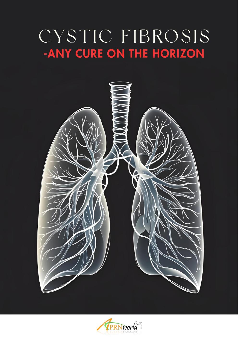 Cystic fibrosis - Any cure on the horizon